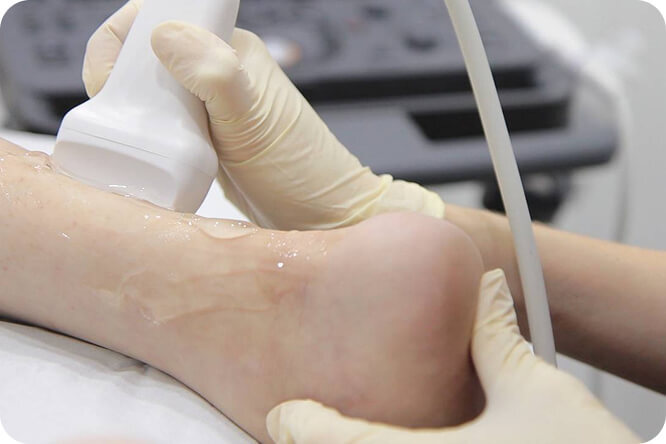 foot