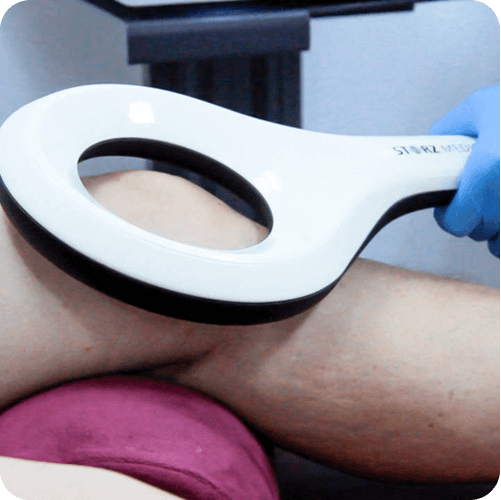 knee apart