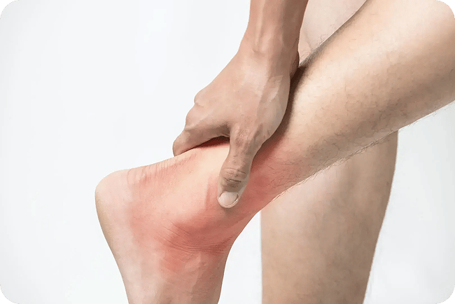 ankle-sprain_1-1