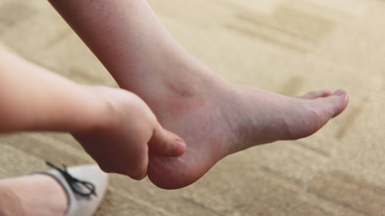 slippers-injury-heels