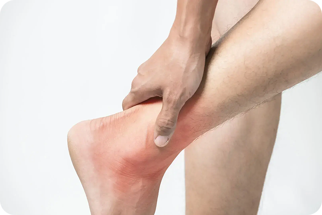 ankle-sprain_1-1